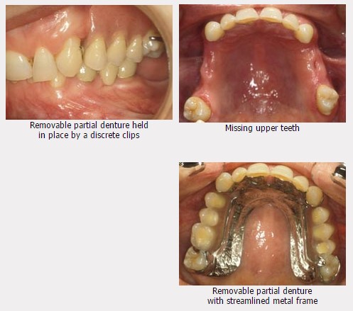 Dental Dentures Portland TN 37148